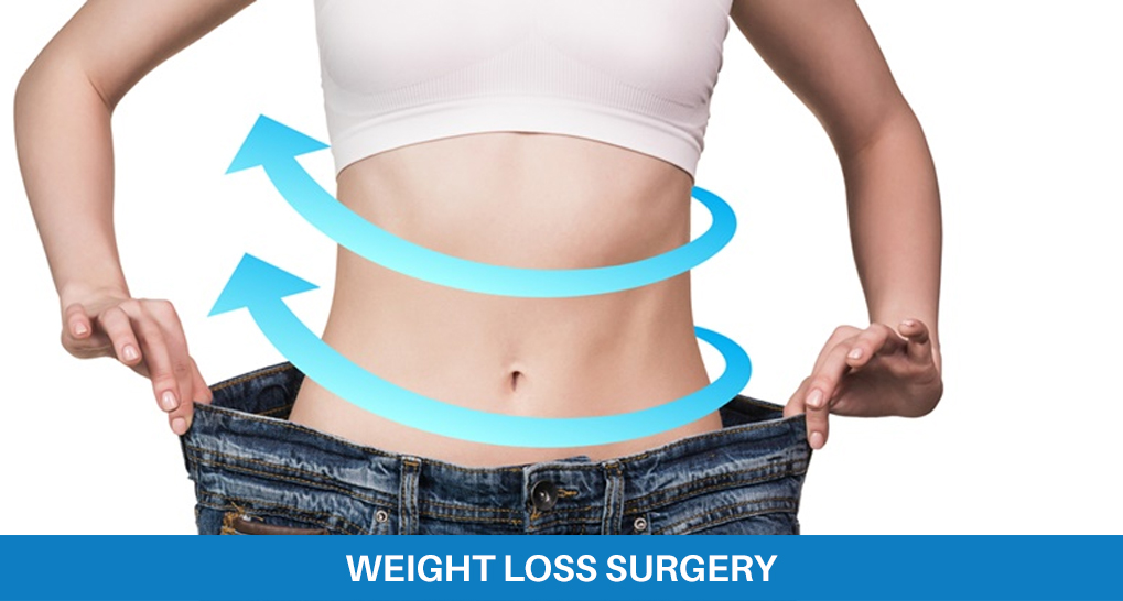 Weight Loss Surgery