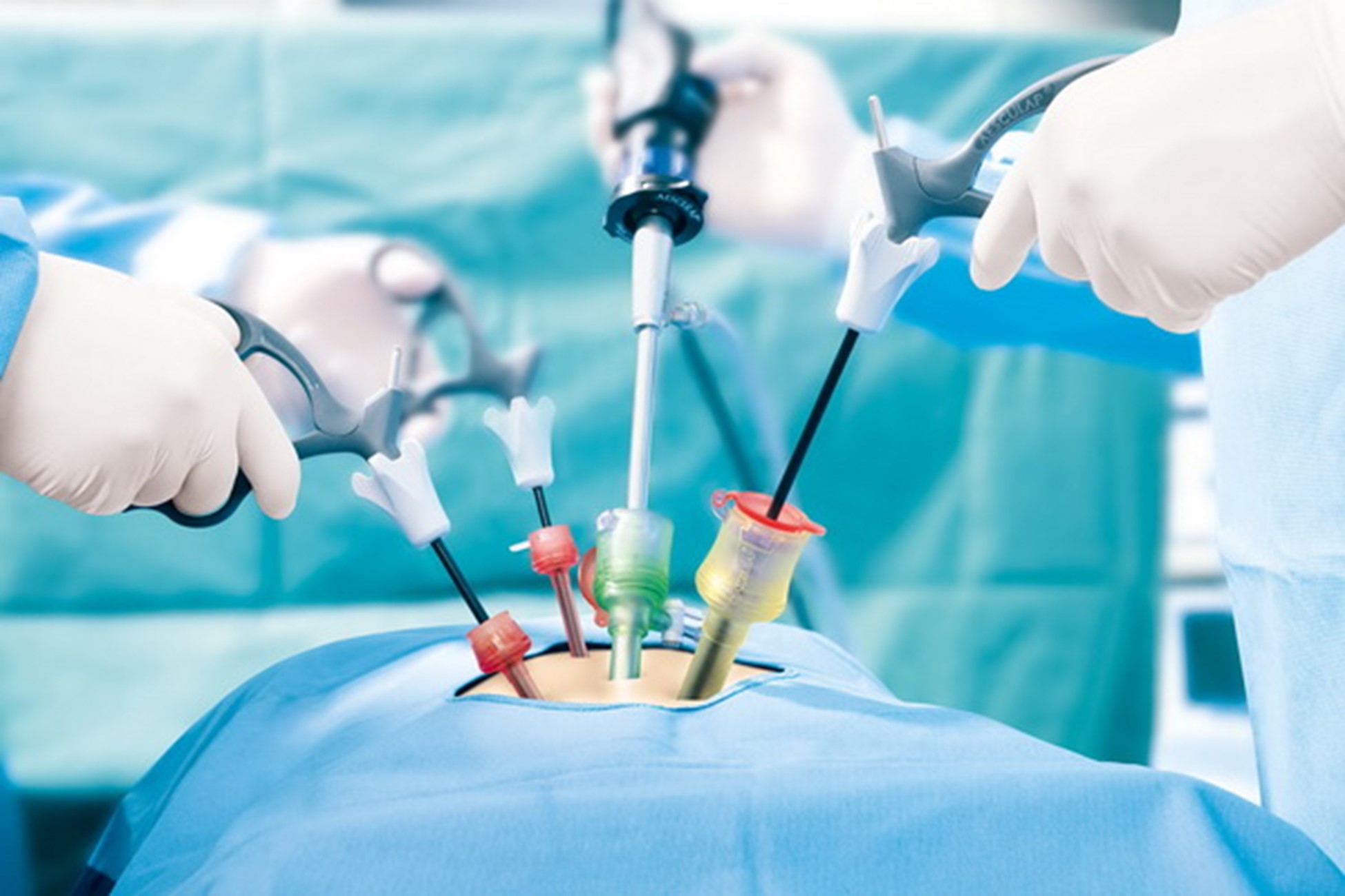 Laparoscopic surgeries