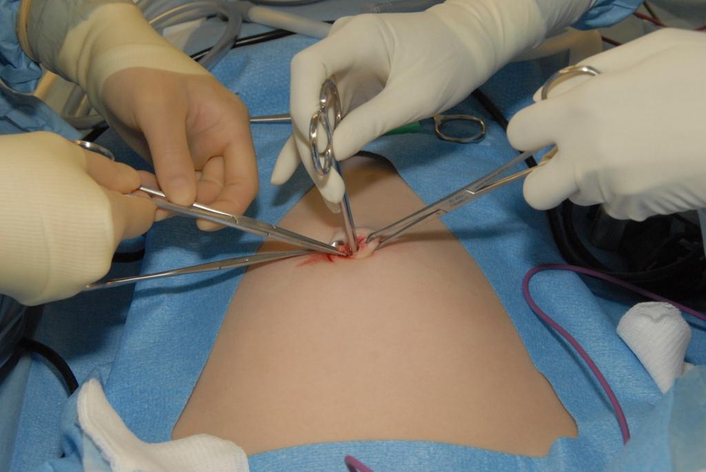 Open Surgery And Laparoscopic Surgery
